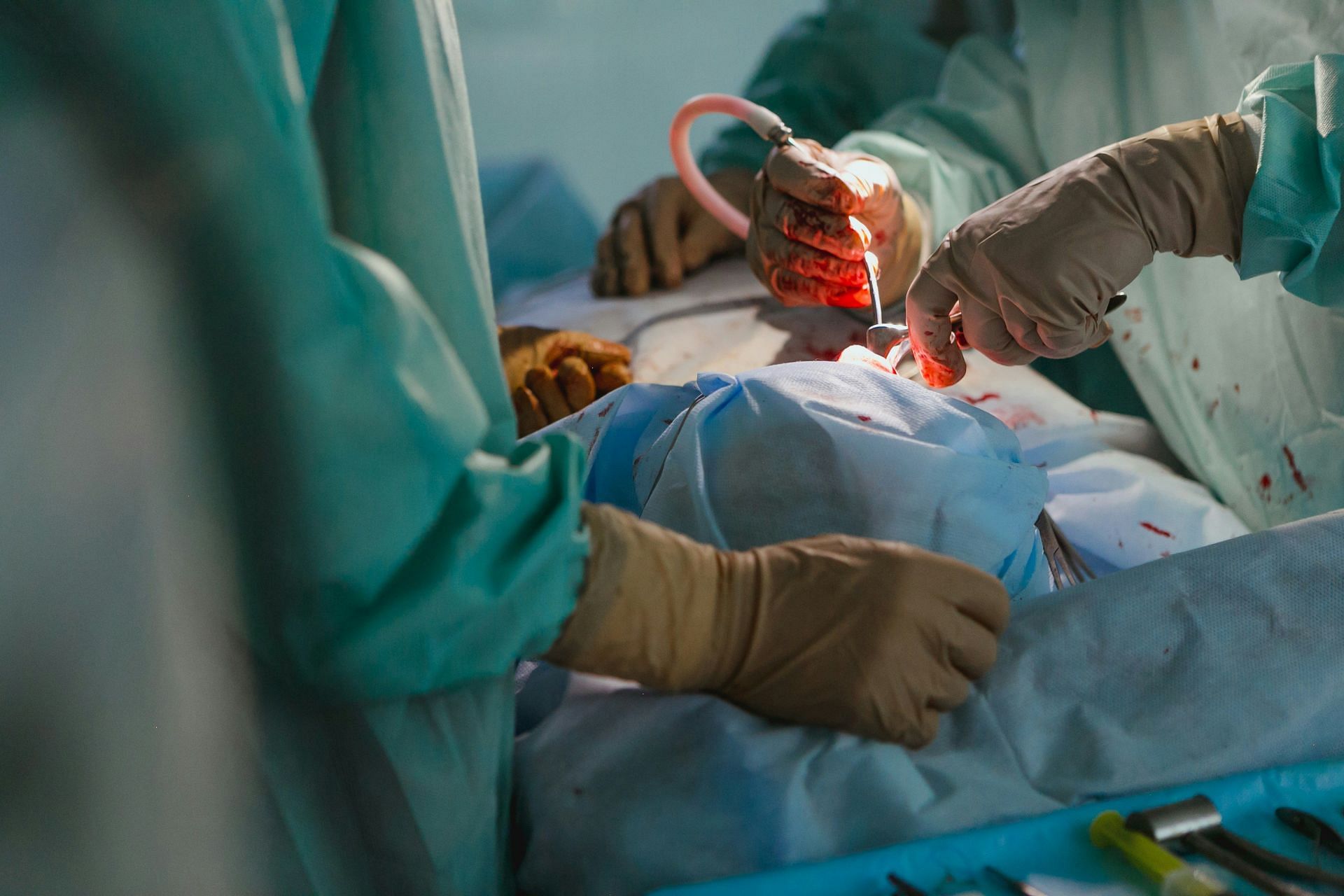 Gallbladder surgery to evade gallbladder attack (Image by Olga Kononenko/Unsplash)